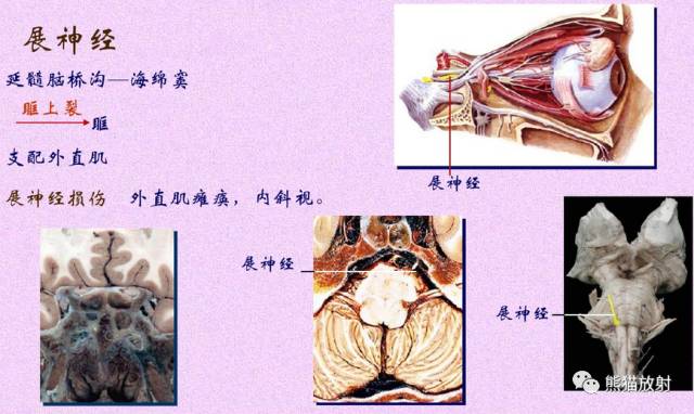 脑神经MRI断层解剖 脑神经MRI断层解剖