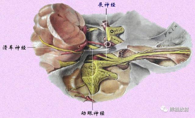 脑神经MRI断层解剖 脑神经MRI断层解剖