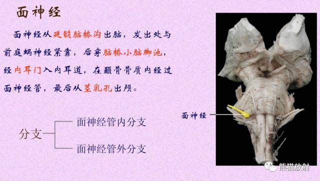 脑神经MRI断层解剖 脑神经MRI断层解剖