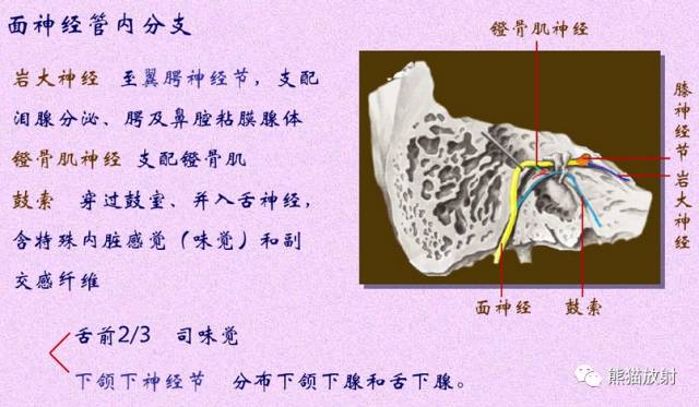 脑神经MRI断层解剖 脑神经MRI断层解剖
