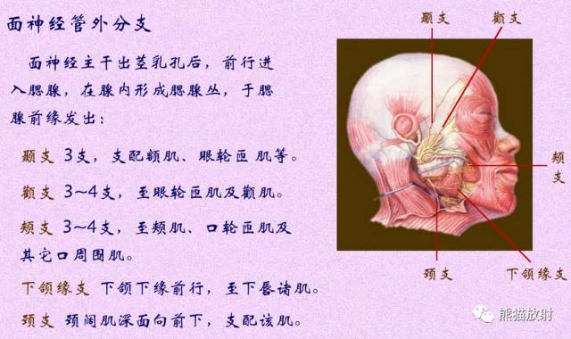 脑神经MRI断层解剖 脑神经MRI断层解剖