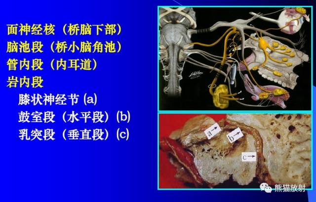 脑神经MRI断层解剖 脑神经MRI断层解剖
