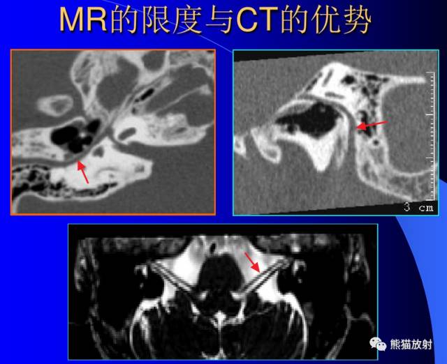 脑神经MRI断层解剖 脑神经MRI断层解剖
