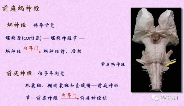 脑神经MRI断层解剖 脑神经MRI断层解剖
