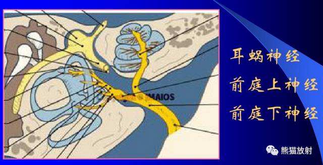 脑神经MRI断层解剖 脑神经MRI断层解剖