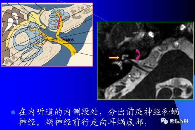 脑神经MRI断层解剖 脑神经MRI断层解剖