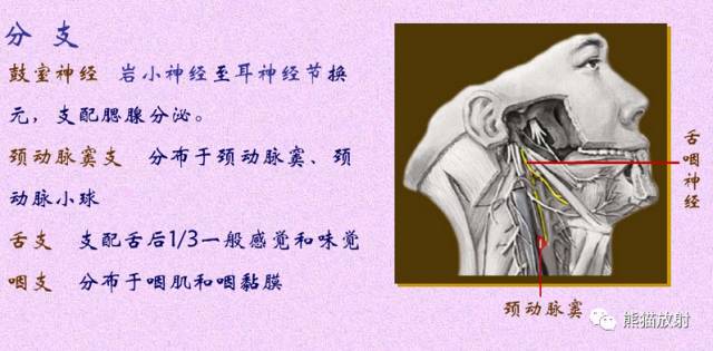 脑神经MRI断层解剖 脑神经MRI断层解剖