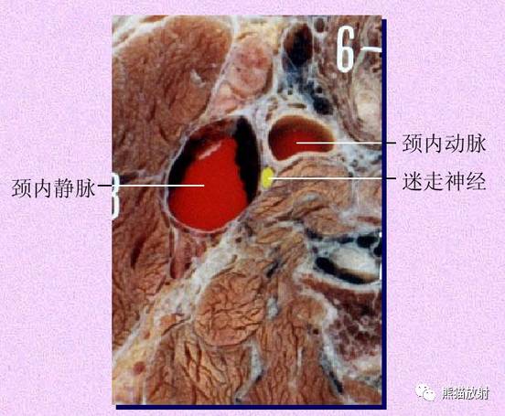 脑神经MRI断层解剖 脑神经MRI断层解剖