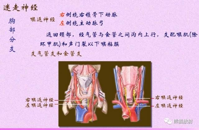 脑神经MRI断层解剖 脑神经MRI断层解剖