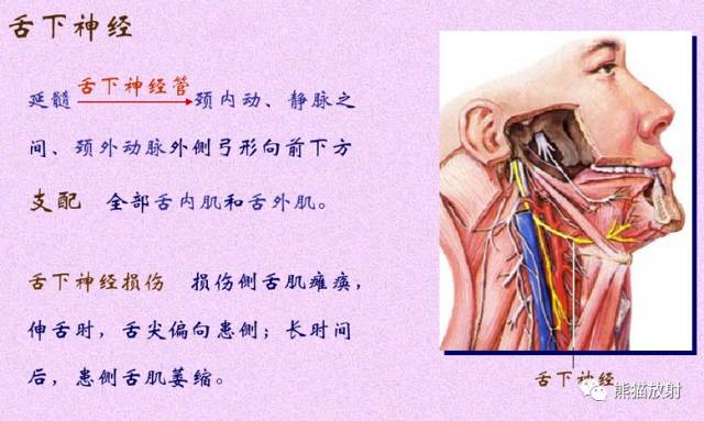 脑神经MRI断层解剖 脑神经MRI断层解剖