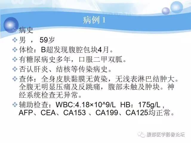 【病例】腹膜后梭形细胞瘤VS神经鞘瘤各1例CT及MR