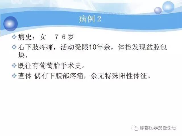 【病例】腹膜后梭形细胞瘤VS神经鞘瘤各1例CT及MR