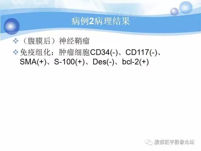 【病例】腹膜后梭形细胞瘤VS神经鞘瘤各1例CT及MR