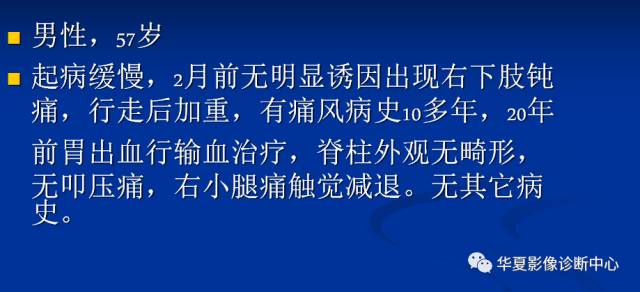【病例】腰椎痛风1例CT影像表现