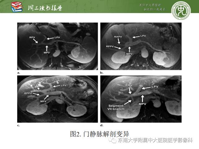 【PPT】肝脏血管性病变影像学表现【RG精选】