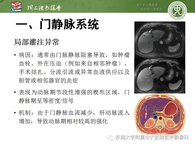 【PPT】肝脏血管性病变影像学表现【RG精选】