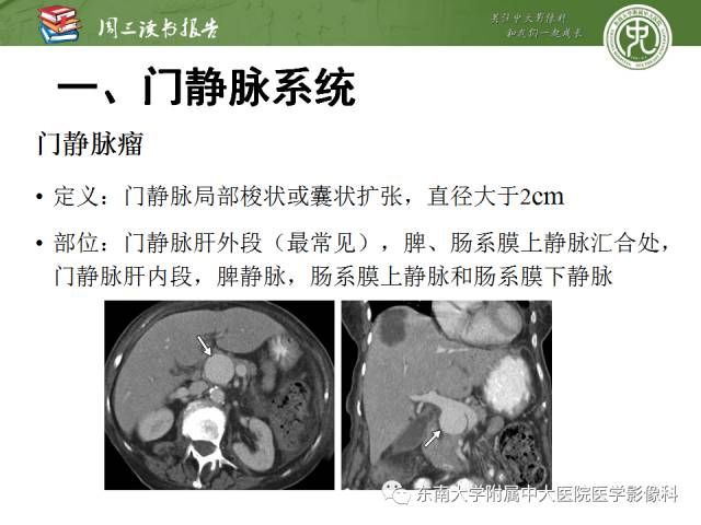 【PPT】肝脏血管性病变影像学表现【RG精选】