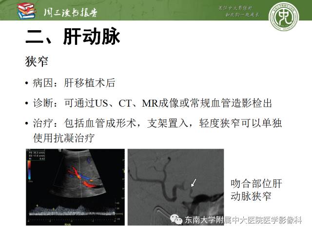 【PPT】肝脏血管性病变影像学表现【RG精选】