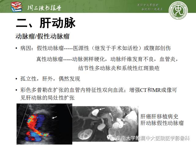 【PPT】肝脏血管性病变影像学表现【RG精选】