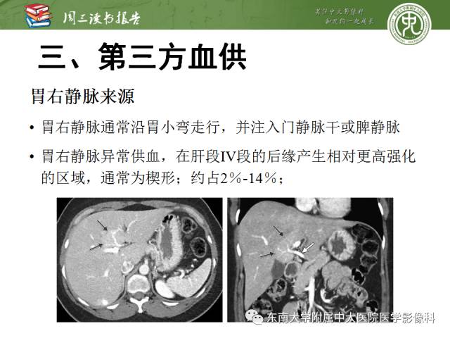 【PPT】肝脏血管性病变影像学表现【RG精选】