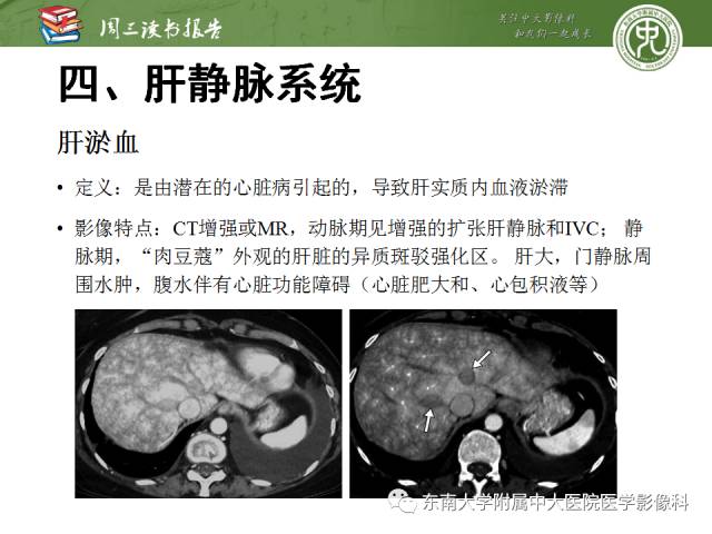 【PPT】肝脏血管性病变影像学表现【RG精选】