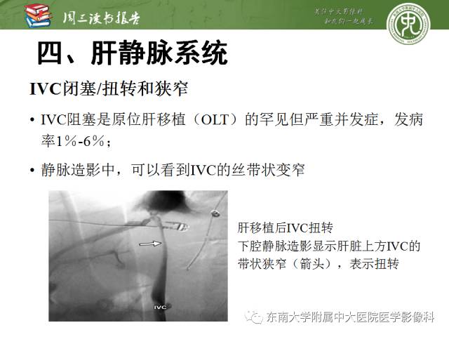 【PPT】肝脏血管性病变影像学表现【RG精选】