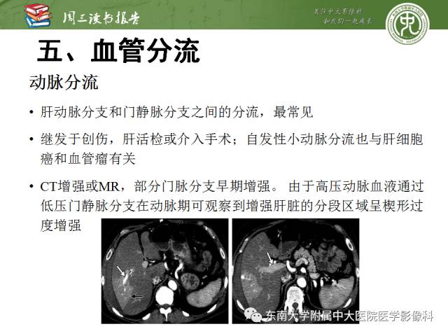 【PPT】肝脏血管性病变影像学表现【RG精选】