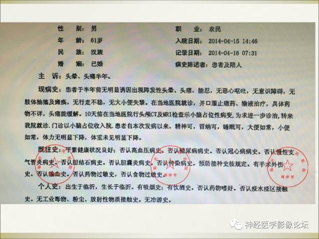 【病例】相似的小脑囊性病变，不一样的病理结果——囊肿VS血管母细胞瘤