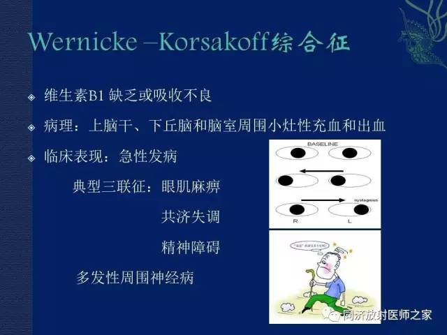 【PPT】酒精相关性脑部改变的影像学表现