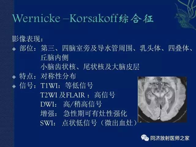 【PPT】酒精相关性脑部改变的影像学表现