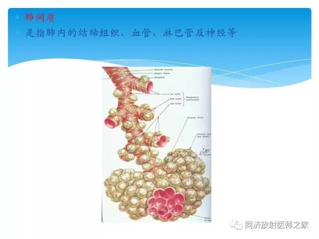 【PPT】肺实质与肺间质的梳理