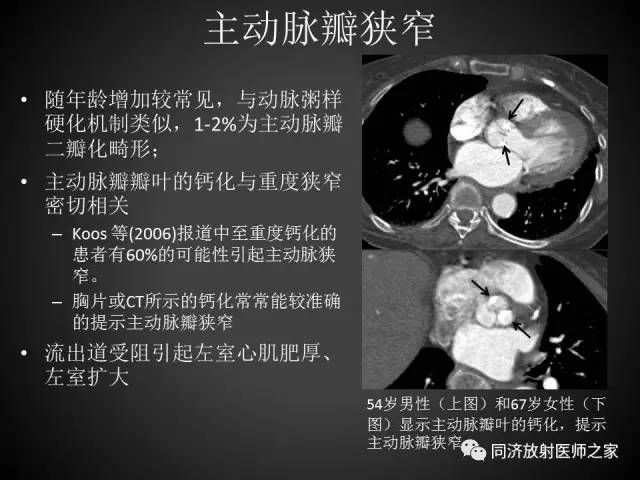 【PPT】心瓣膜病的X线和CT表现