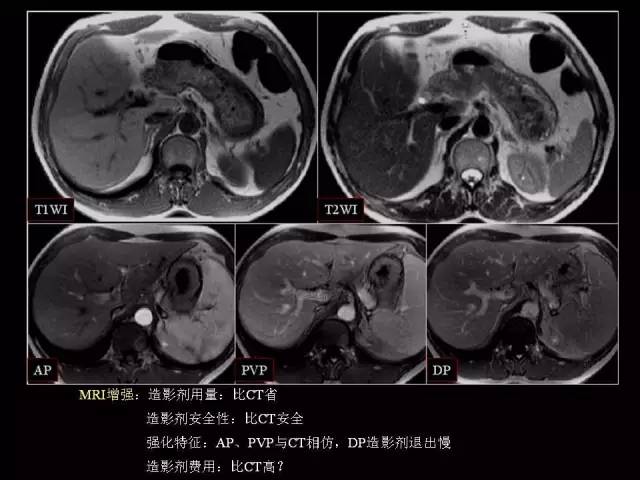 【PPT】肝脏解剖与常见变异
