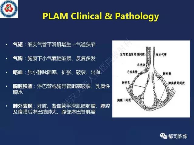 【PPT】肺淋巴管肌瘤病影像诊断