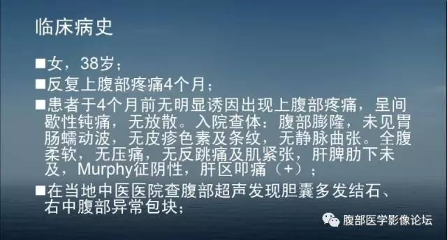 【病例】胃肠道间质瘤1例CT影像表现