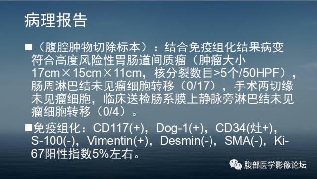 【病例】胃肠道间质瘤1例CT影像表现