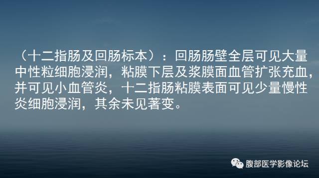 【病例】胃肠道间质瘤1例CT影像表现