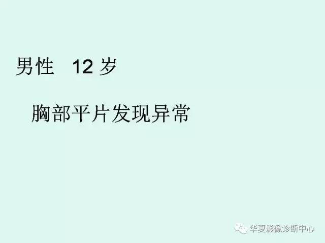【病例】神经节细胞瘤一例CT及MR