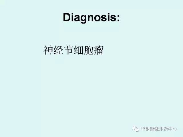 【病例】神经节细胞瘤一例CT及MR