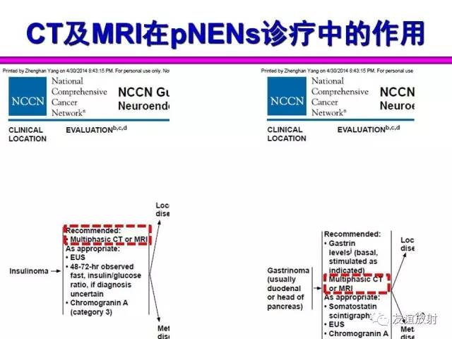 【PPT】胰腺神经内分泌肿瘤(pNet)的CT、MRI检查与诊断