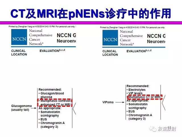 【PPT】胰腺神经内分泌肿瘤(pNet)的CT、MRI检查与诊断