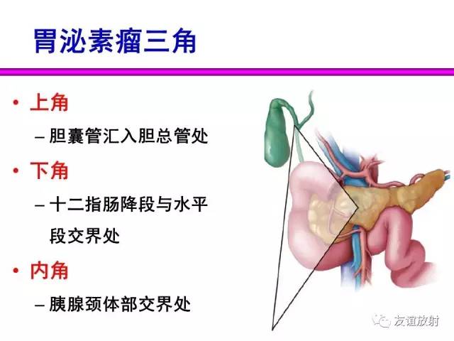 【PPT】胰腺神经内分泌肿瘤(pNet)的CT、MRI检查与诊断