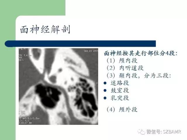 【PPT】外中耳解剖及变异畸形CT表现