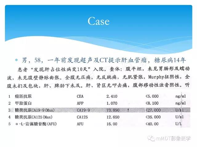 【PPT】胆管细胞癌