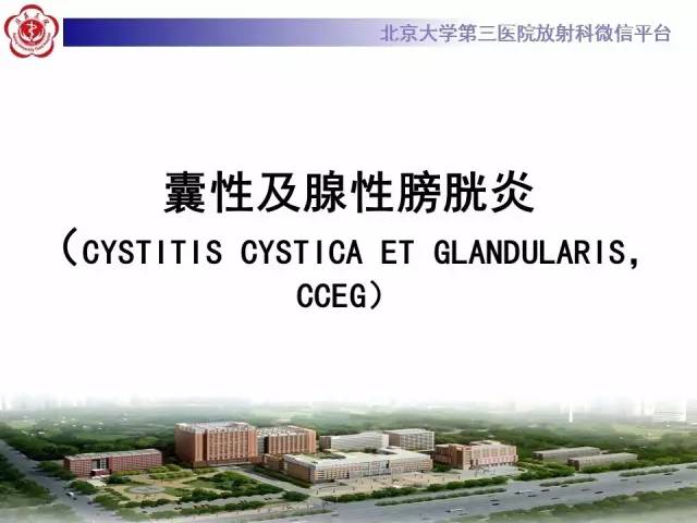 【病例】腺性膀胱炎1例CT影像表现与鉴别
