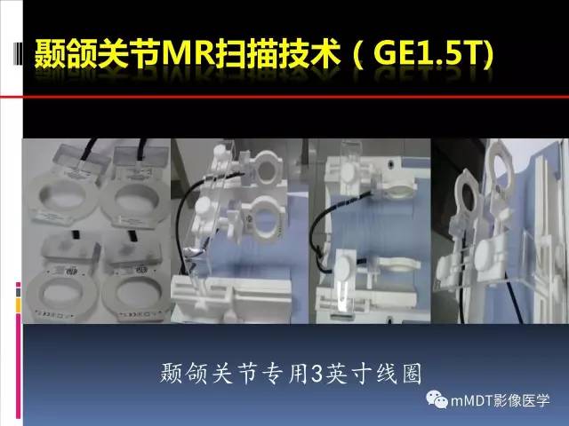 【PPT】颞下颌关节的磁共振成像(检查技术与解剖部分)