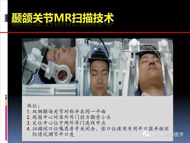 【PPT】颞下颌关节的磁共振成像(检查技术与解剖部分)