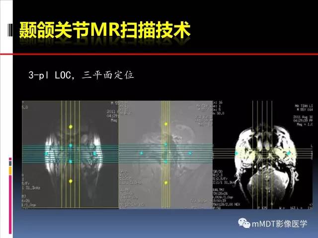 【PPT】颞下颌关节的磁共振成像(检查技术与解剖部分)