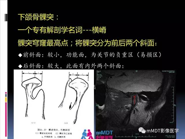 【PPT】颞下颌关节的磁共振成像(检查技术与解剖部分)