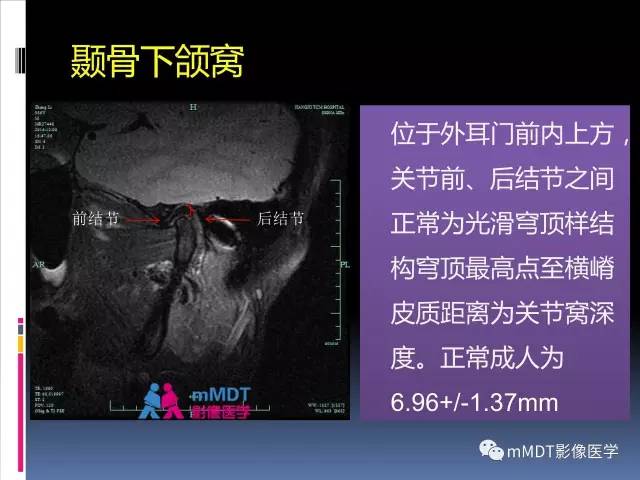 【PPT】颞下颌关节的磁共振成像(检查技术与解剖部分)